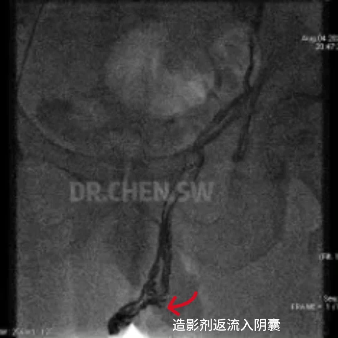 視頻封面