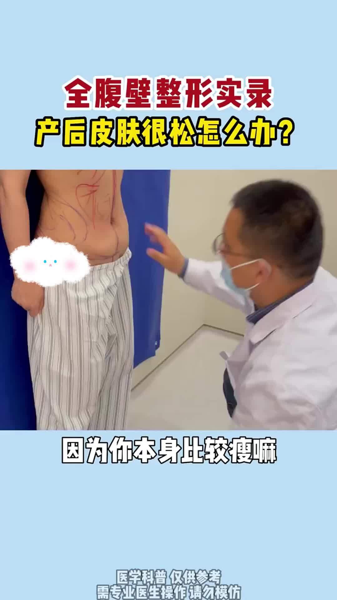 腹壁整形是一种不断发展变化的整形外科手术 - 知乎