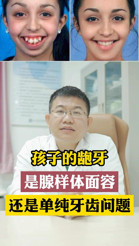 視頻封面