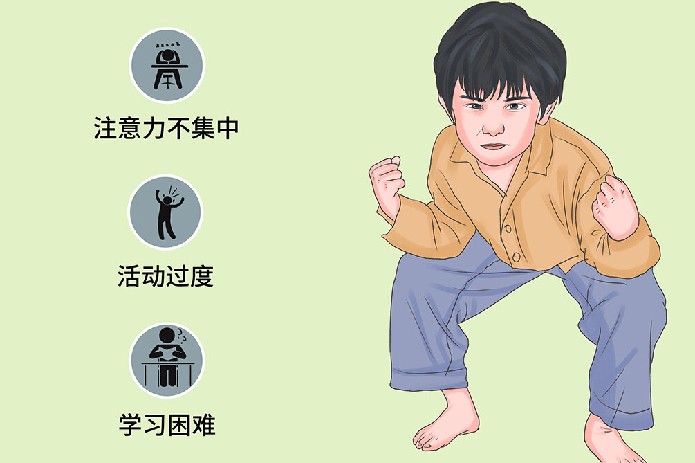 圖文圖片