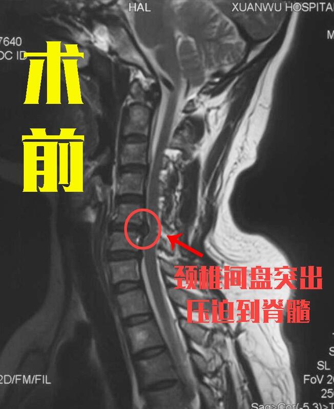 圖文圖片