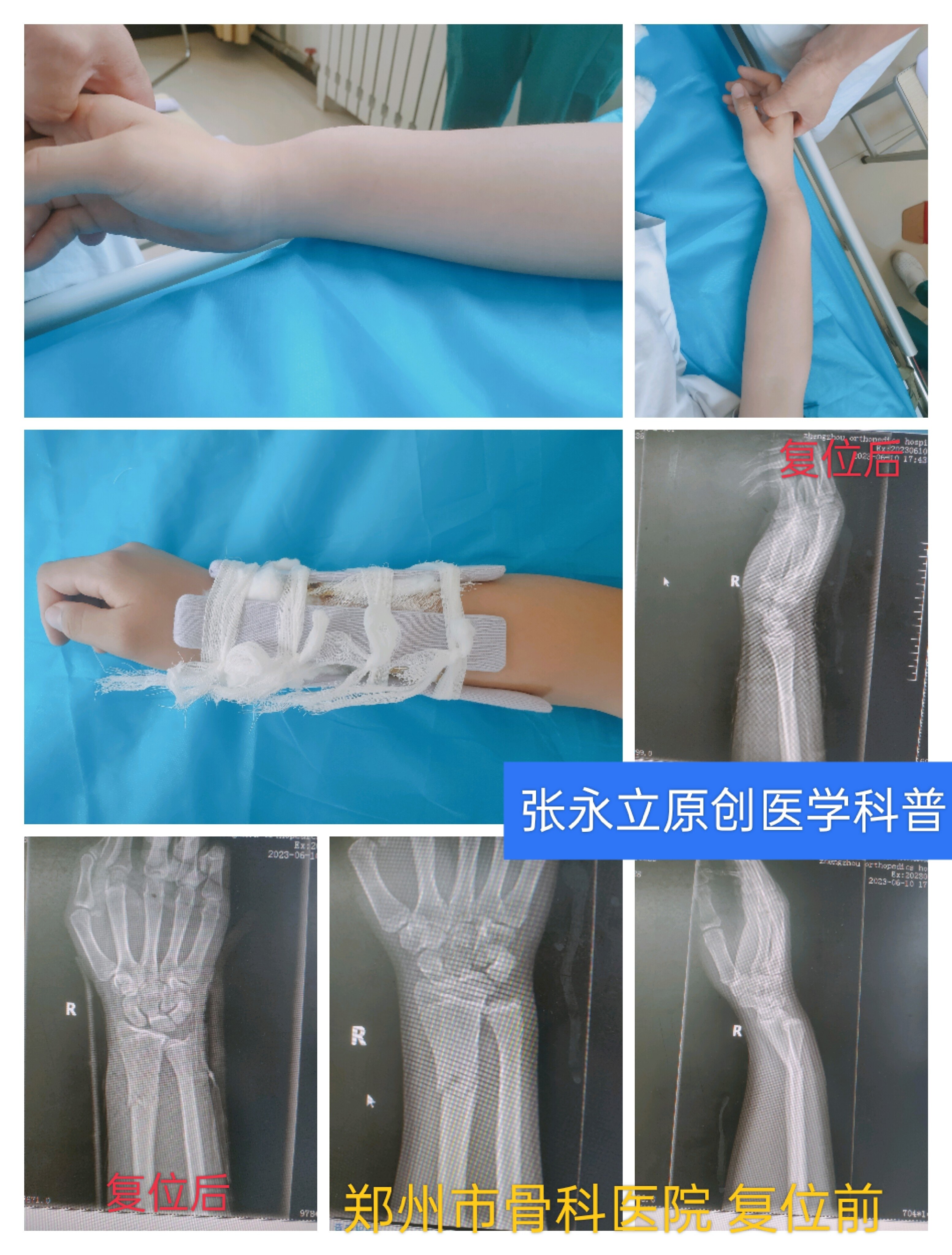 郑州市骨科医院专家预约挂号,只需要您的一个电话的简单介绍 郑州市骨科医院专家预约挂号,只需要您的一个电话的简单介绍