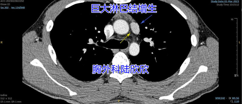 圖文圖片