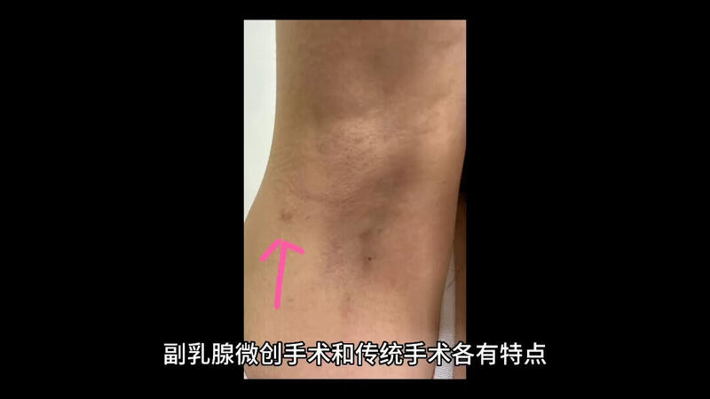 視頻封面