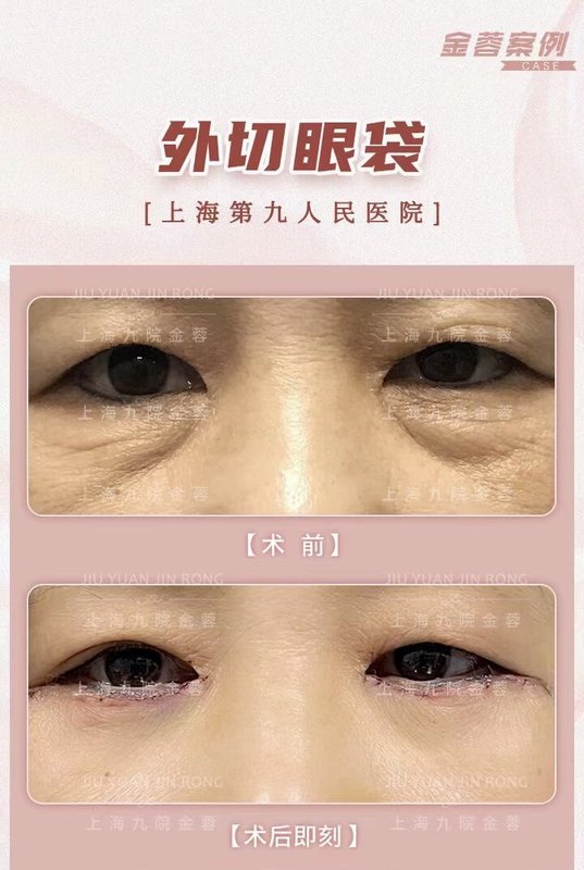 圖文圖片