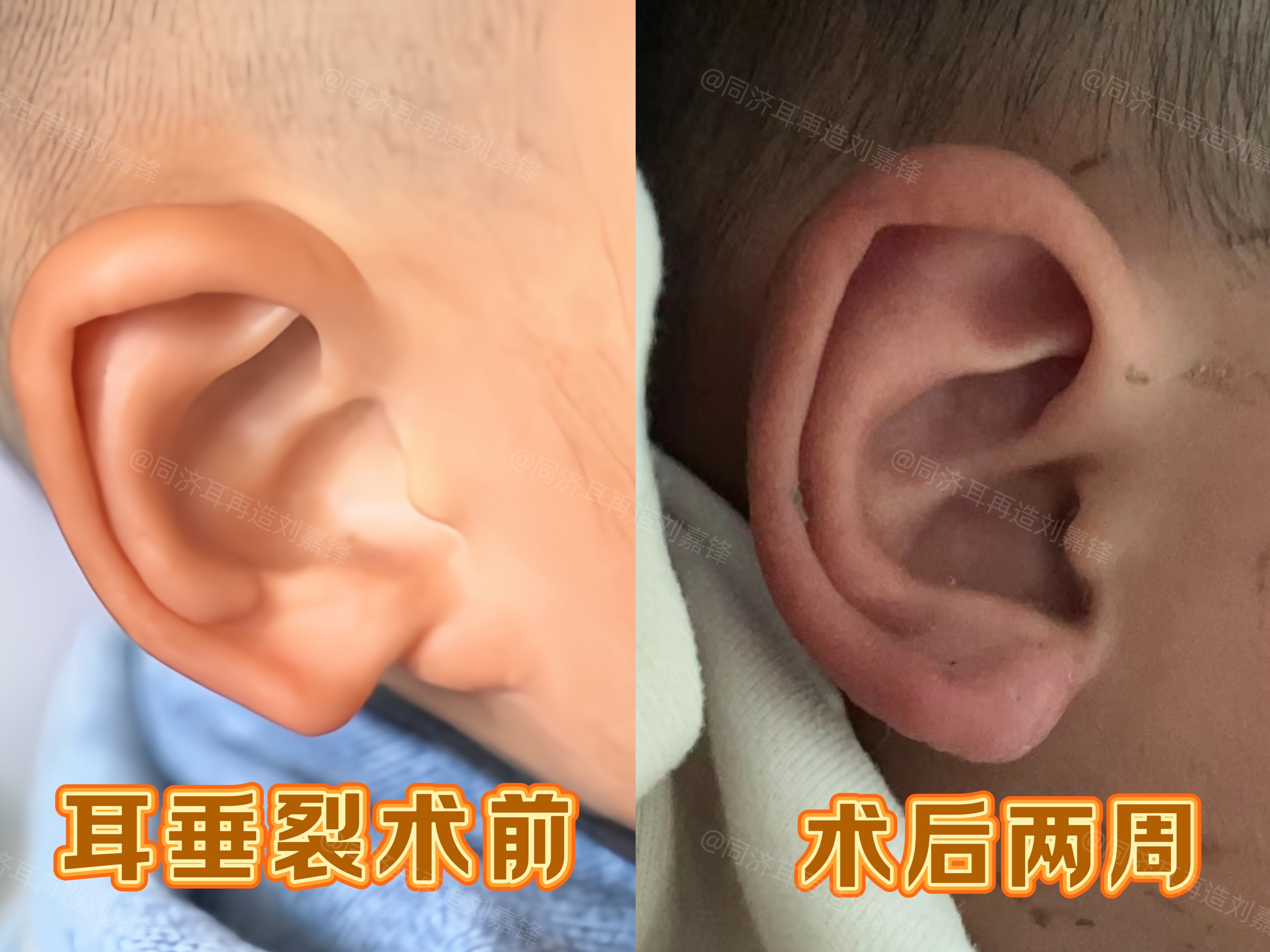 圖文圖片