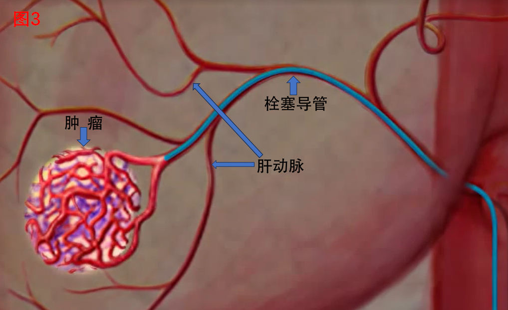 圖文圖片