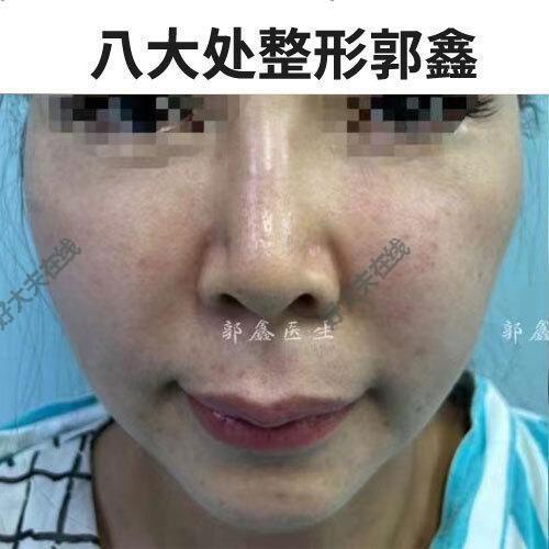 圖文圖片
