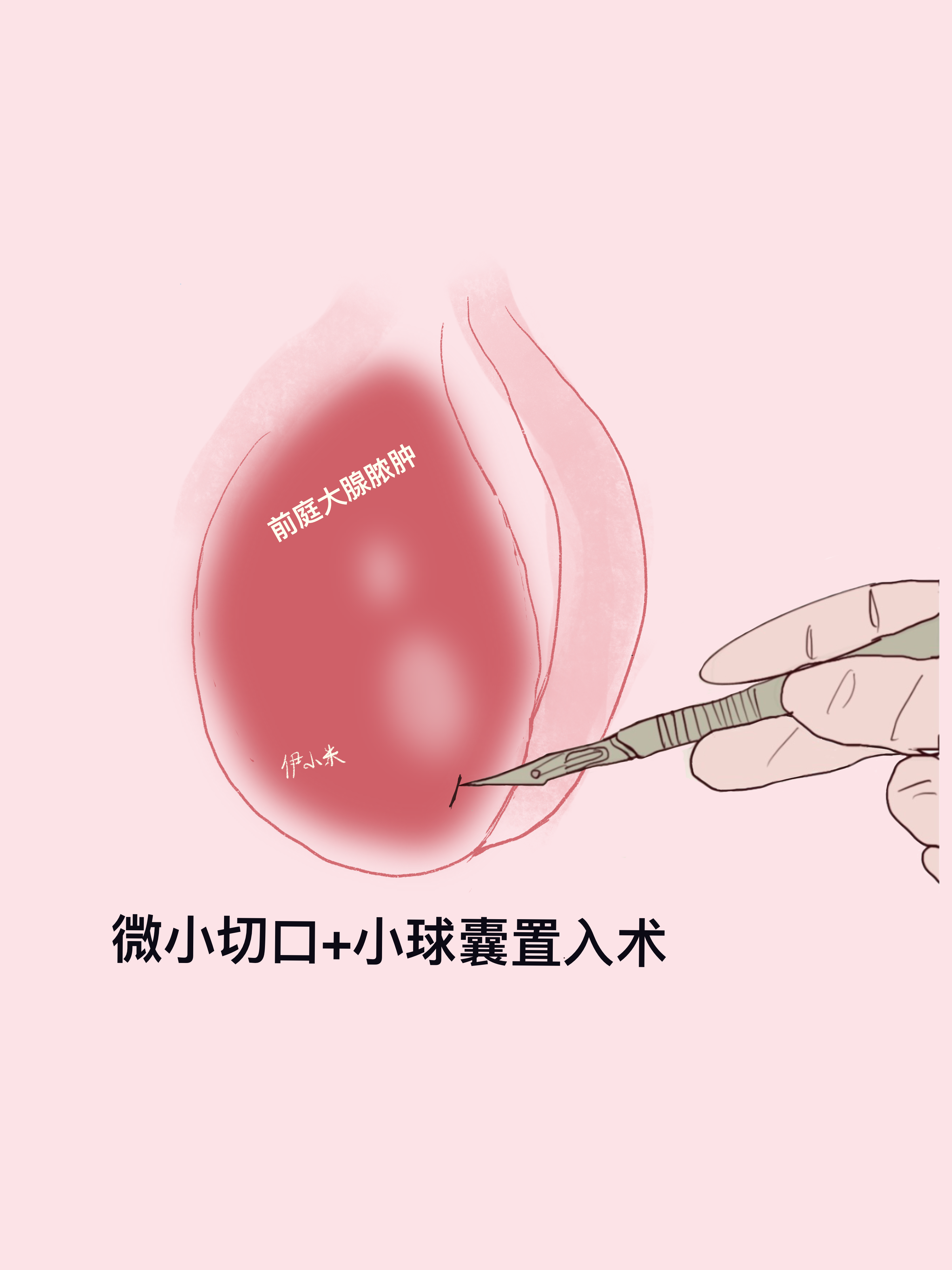 图文图片