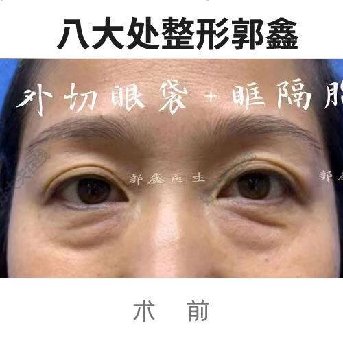 圖文圖片