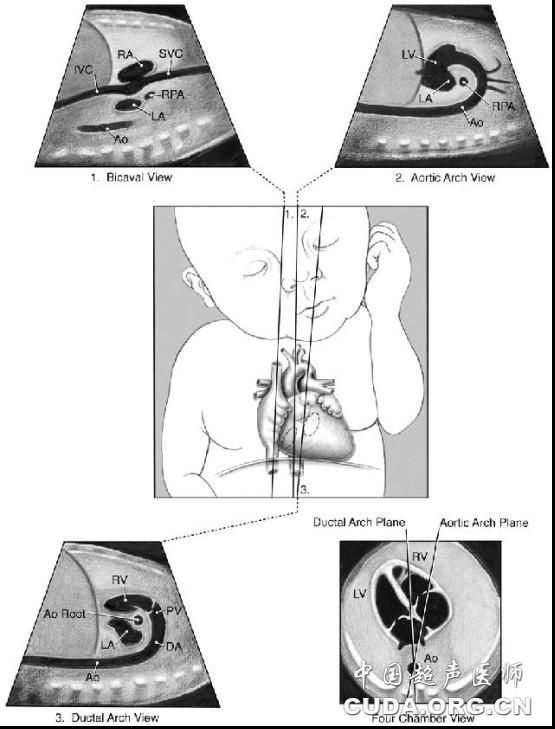美国医学超声协会胎儿超声心动图操作指南