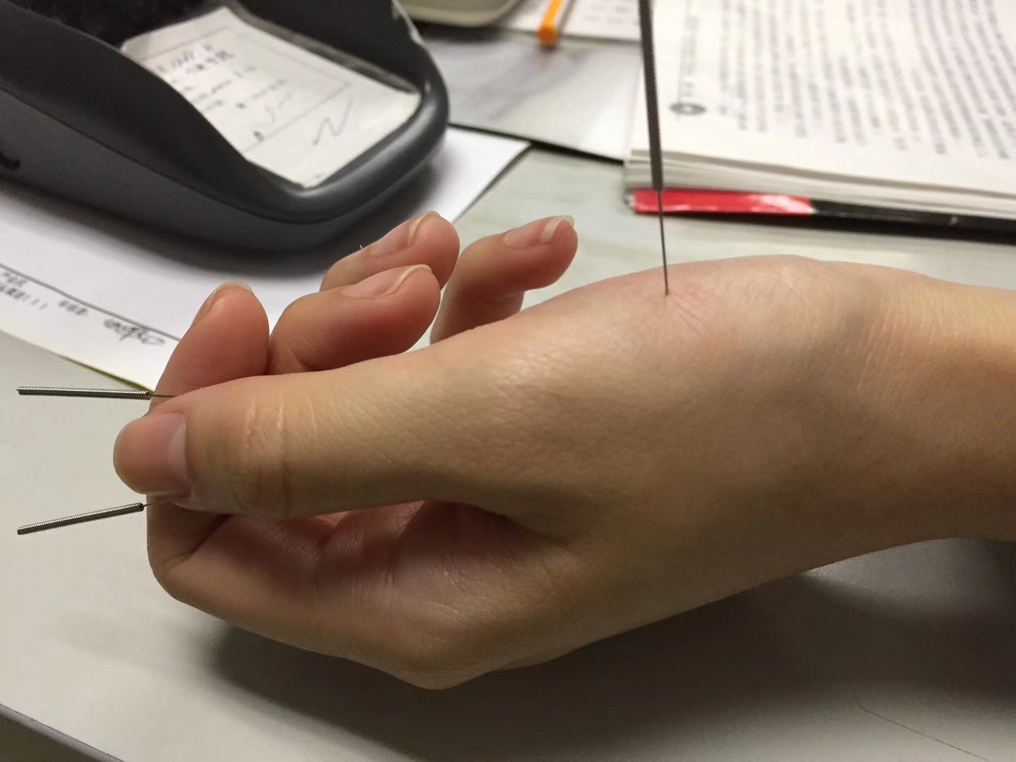 阴阳九针～手上中医 - 好大夫在线