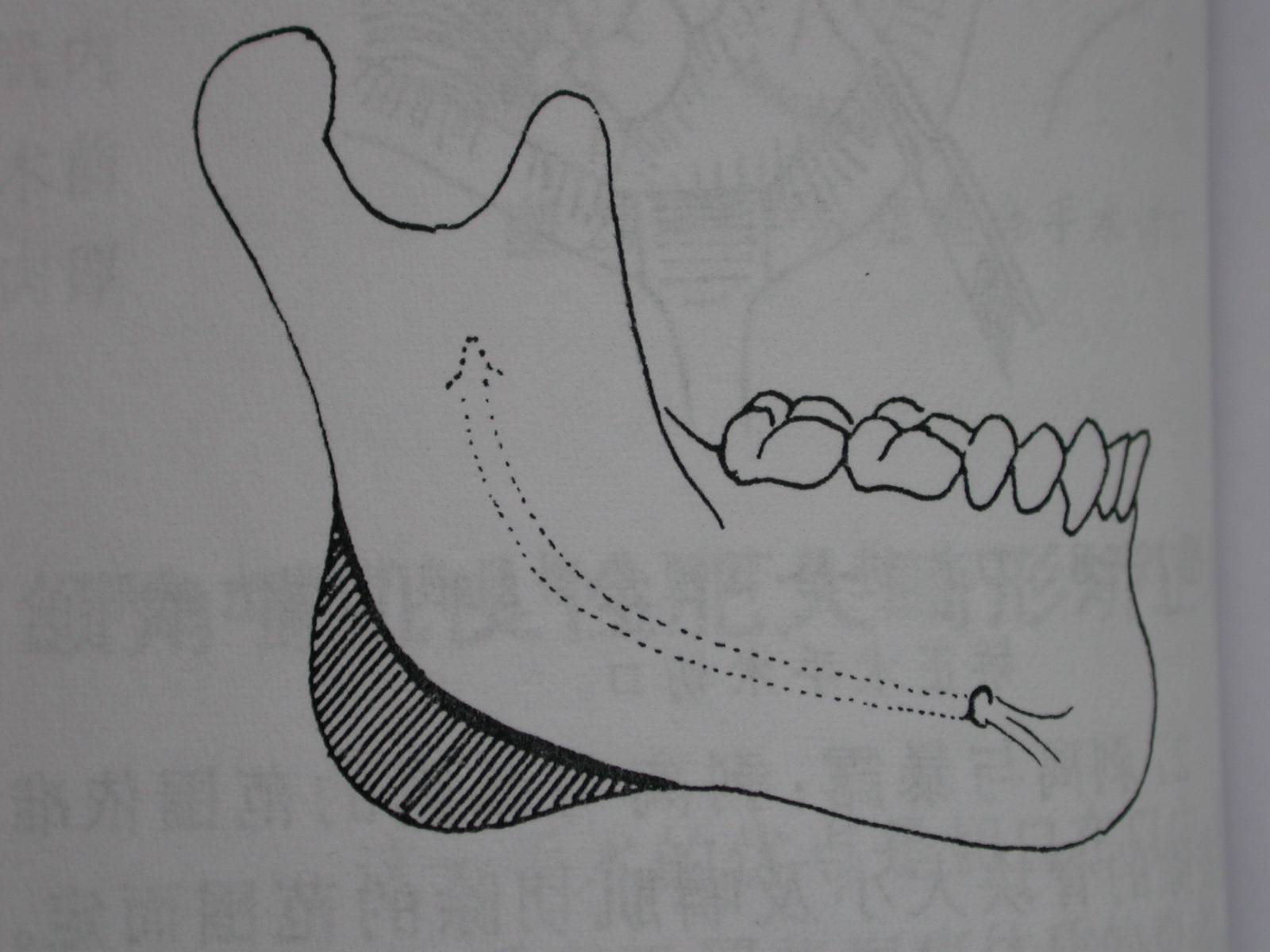 下颌骨手绘图图片