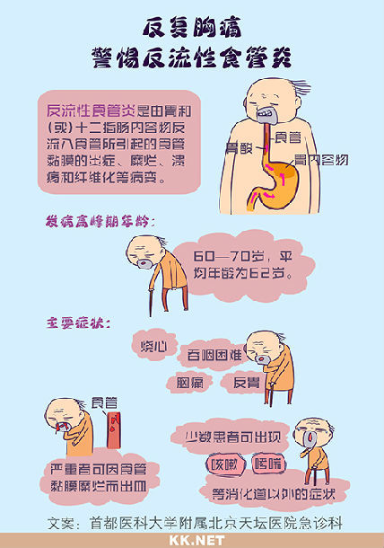 反复胸痛警惕反流性食管炎