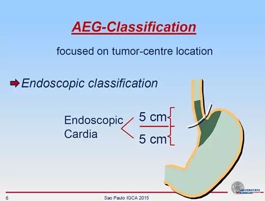 aeg不同分型之間在流行病學,治療,預後等方面可能都存在不同.