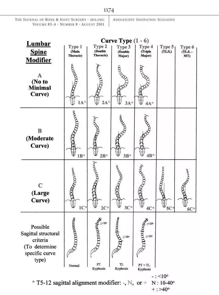 脊柱侧弯lenke分型图谱图片