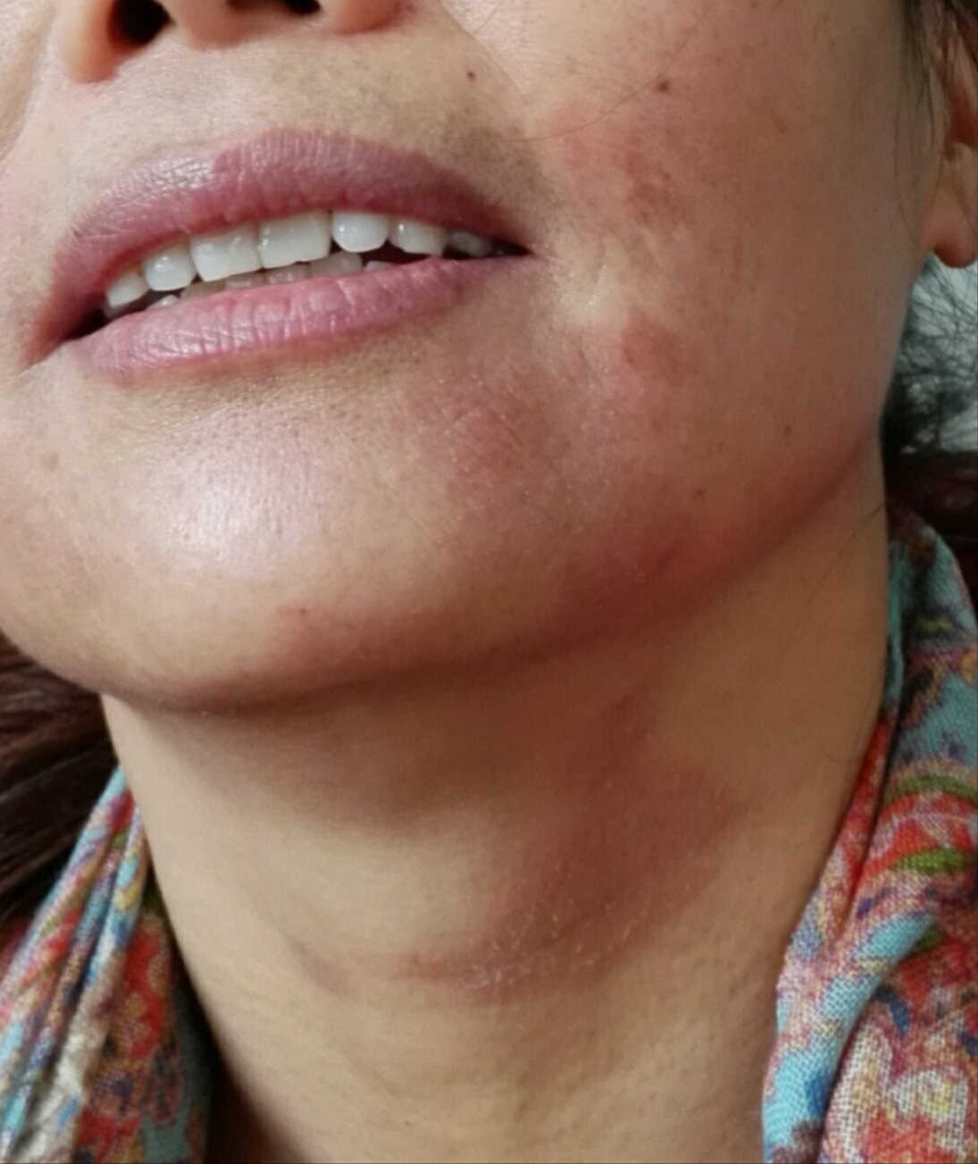 面部过敏案 - 好大夫在线