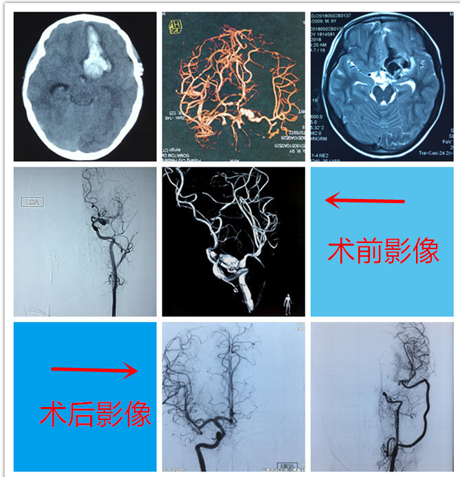 xIYBAFuEDG2AOhqhAAIN8fCjtDM047.jpg?_ms_=2bcb