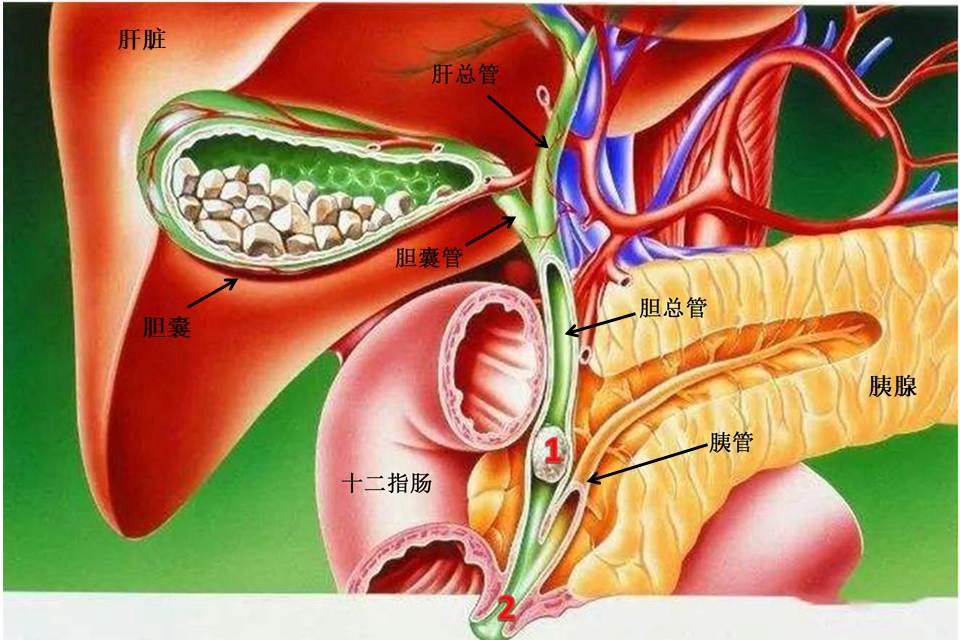 胆总管内径图片