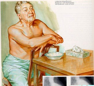 当患者心衰症状急性加重时应采用端坐卧位同时双下肢下垂.