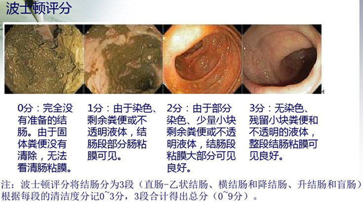 肠道准备清洁图片