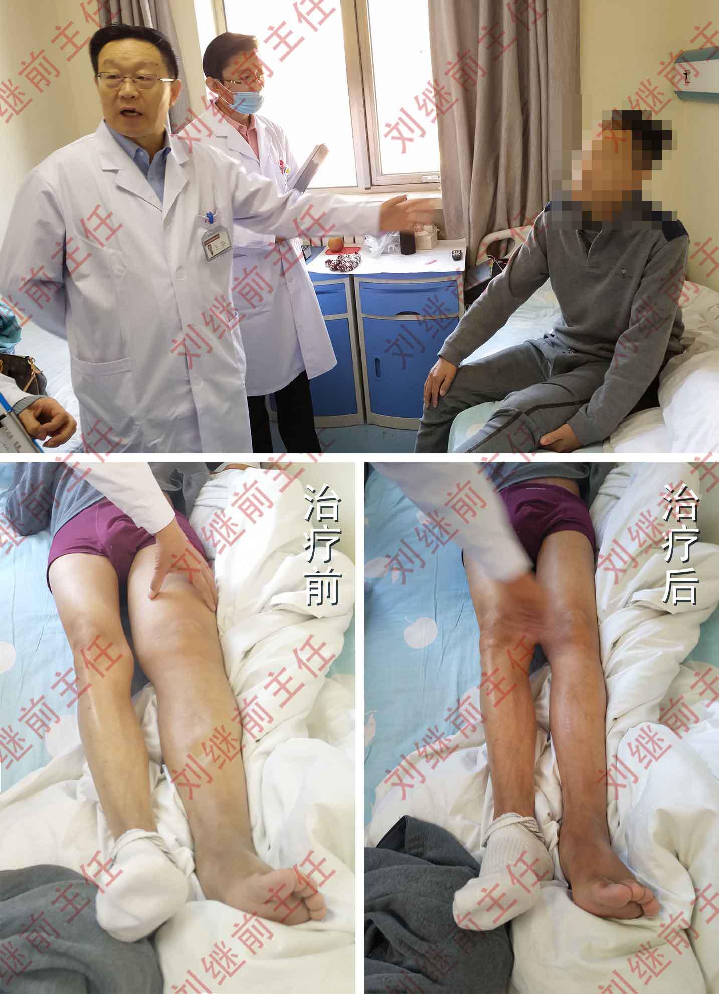 中药搭配中医 一周解决下肢水肿问题 中药搭配中医 一周解决下肢水肿问题