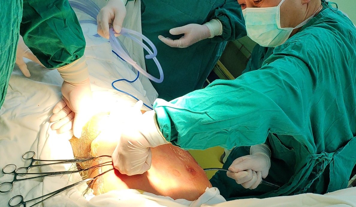 今天的bleedingless手术: 3条钢板,无一滴出 - 好大夫在线