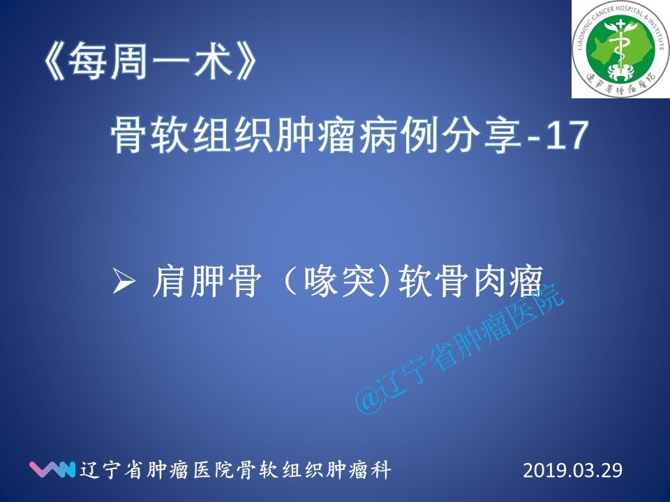 肩胛骨喙突软骨肉瘤手术