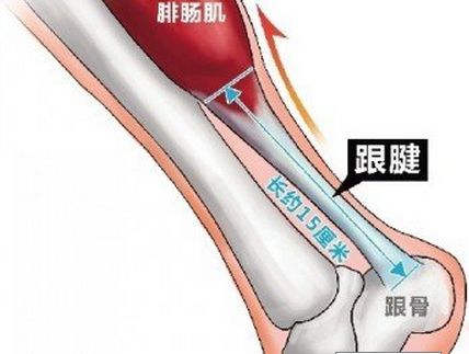 跟腱断裂的症状及预防 跟腱断裂多久才能恢复 跟腱断裂