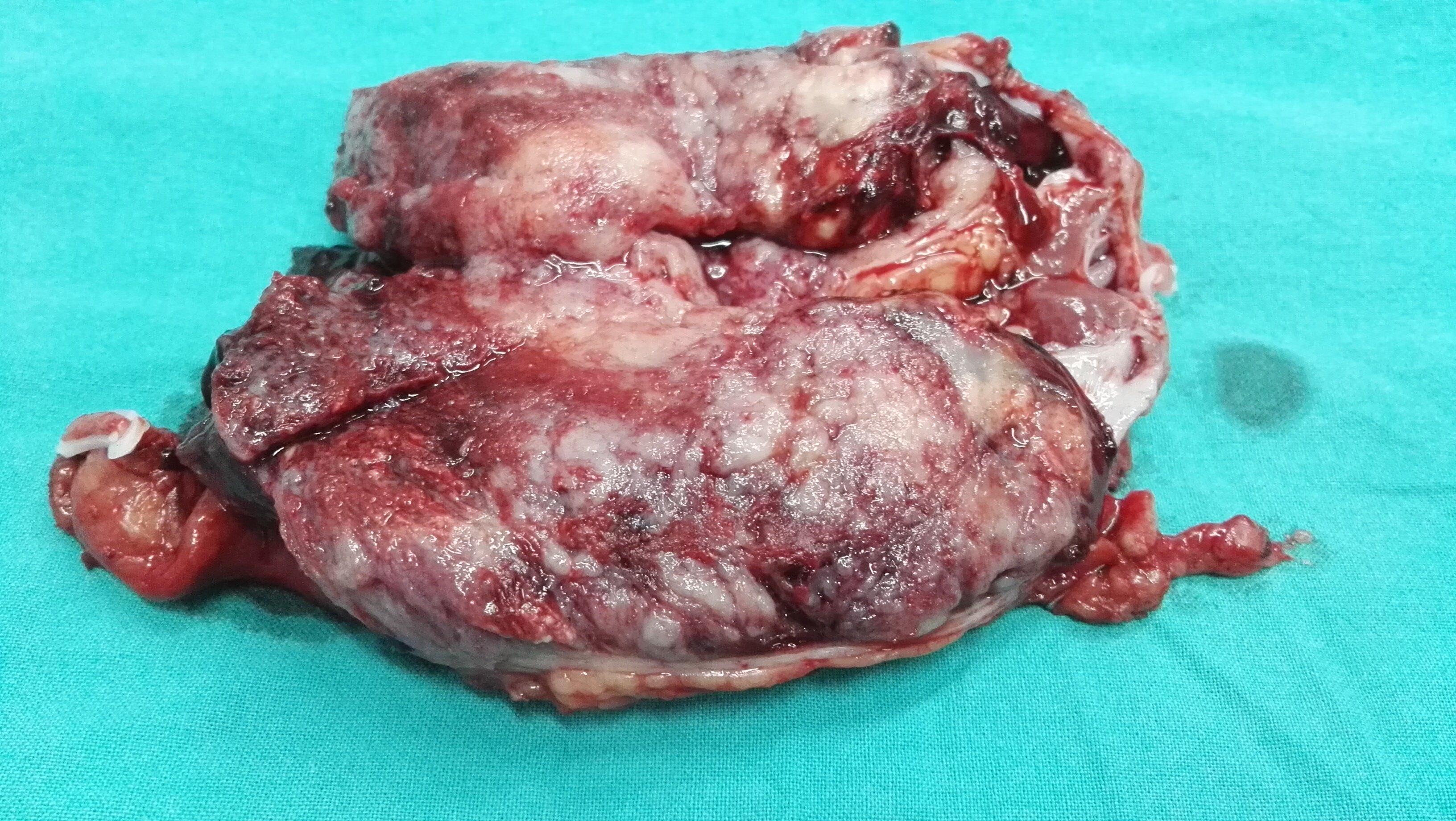 婴儿手足口初期症状是什么样子_婴儿手足口病初期症状图片_婴儿手足口早期症状