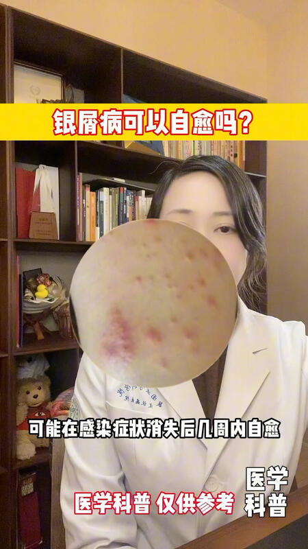 視頻封面