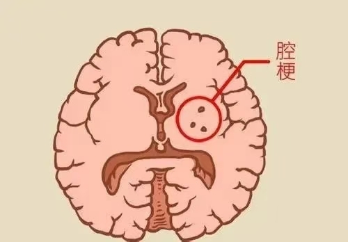 圖文圖片