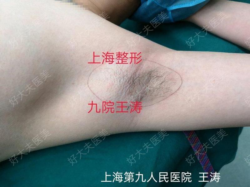 圖文圖片