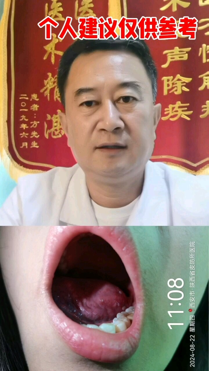 默认图片