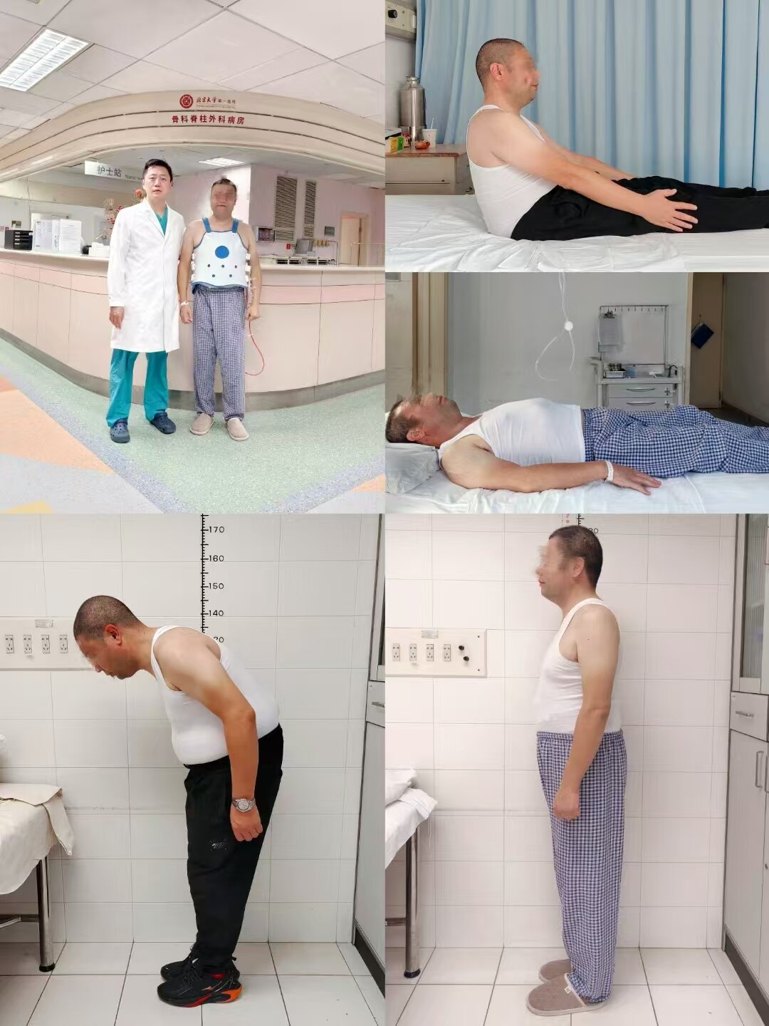 强直3.jpg