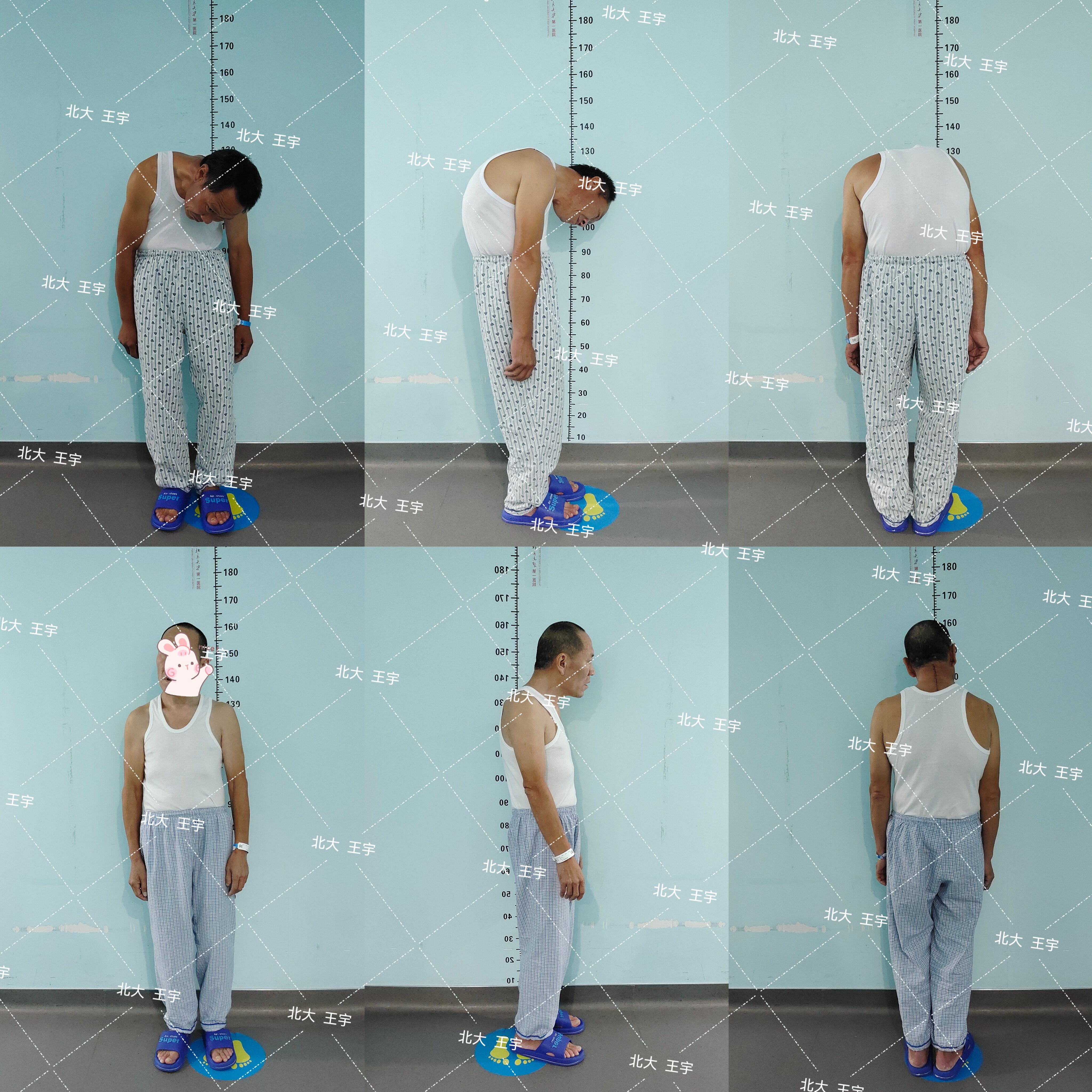 强直4.jpg