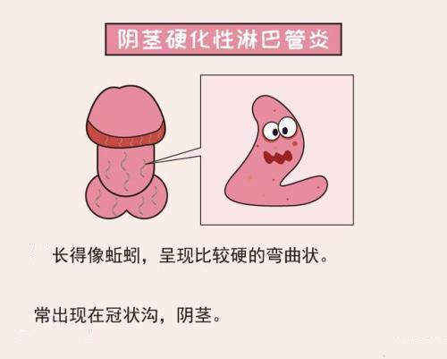 1587711509740965.jpg 2.jpg