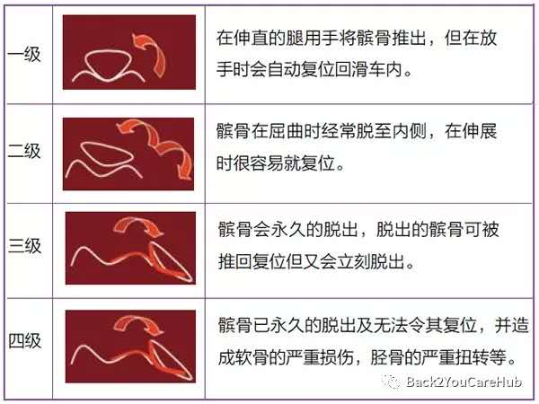 髌骨脱位的简单分级通俗的来说就是膝盖骨偏离了股骨滑车的轨道,"骑"