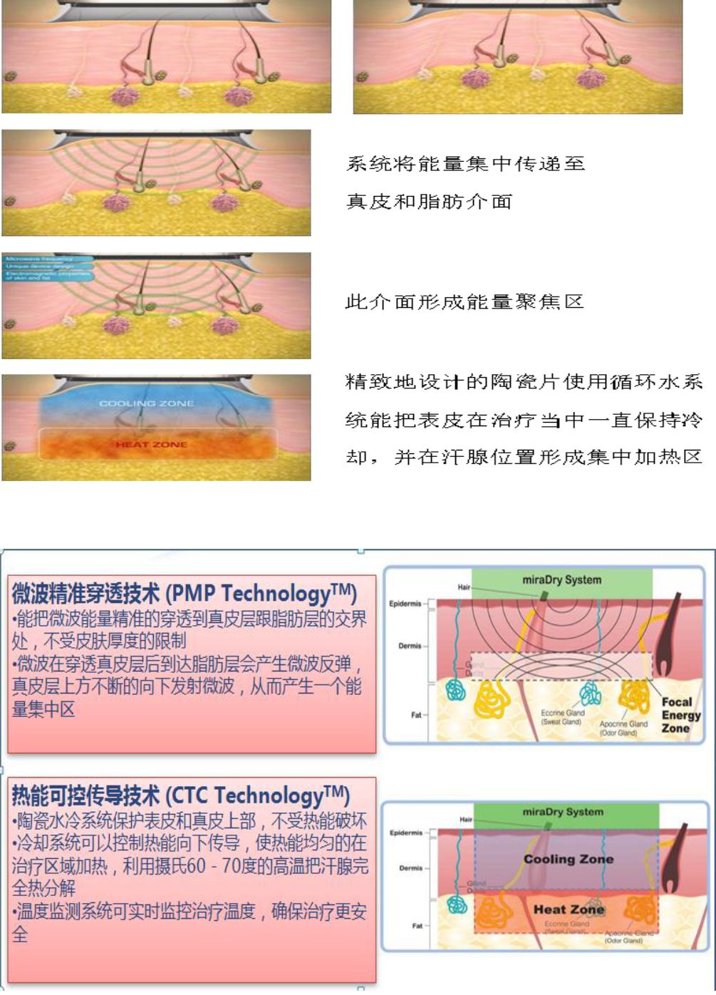 微波治疗狐臭图片