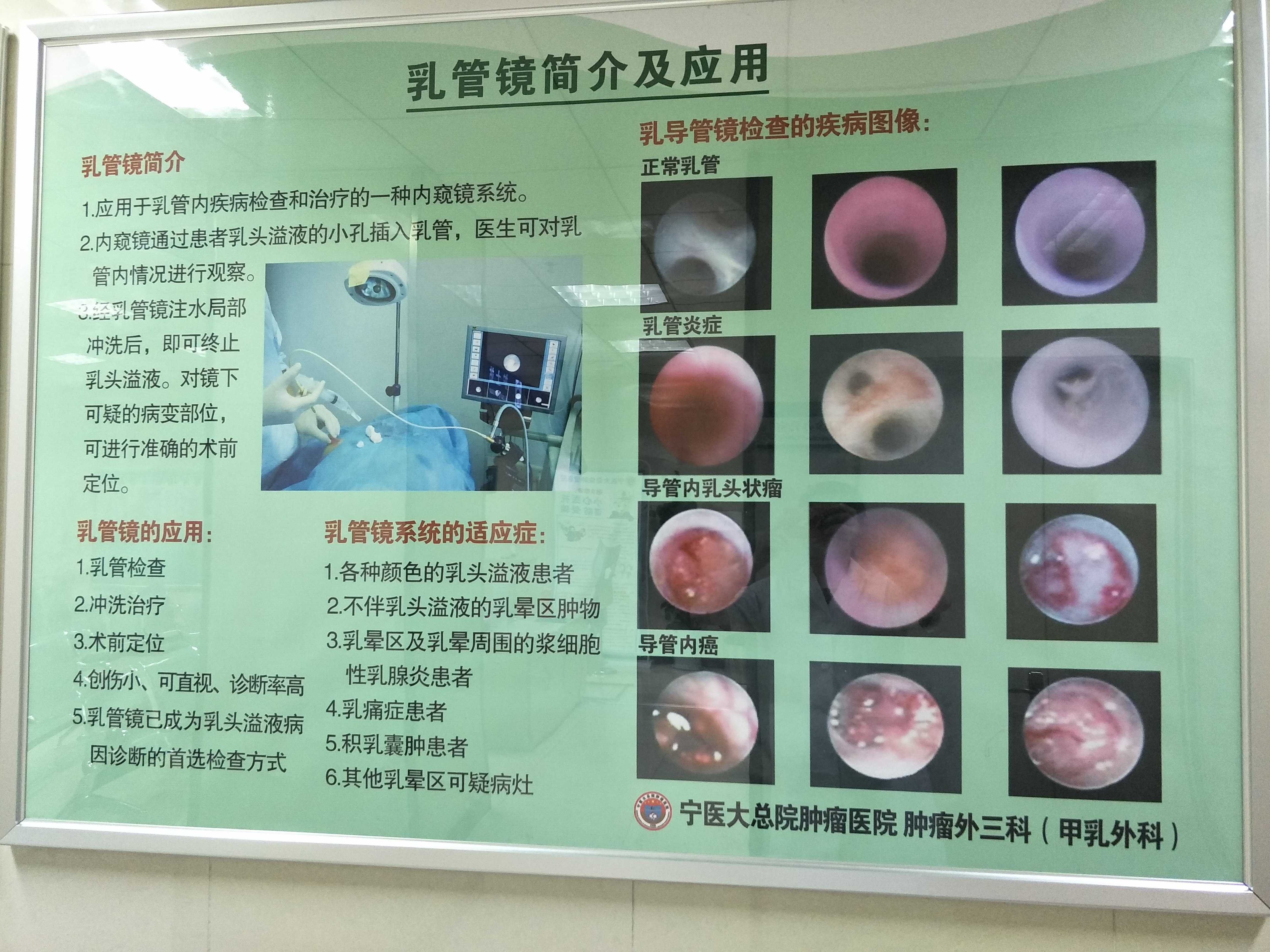 乳头溢液 小毛病 大麻烦 乳腺疾病 乳腺疾病疾病介绍