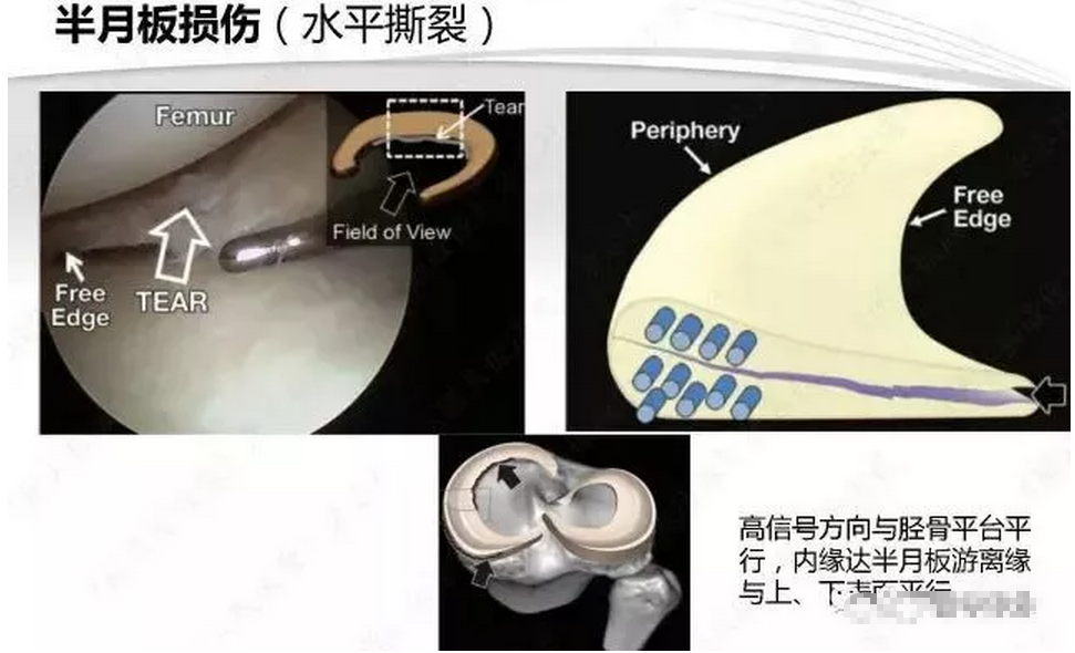 骨科;浙江大學骨科研究所;浙江大學李達三·葉耀珍再生醫學發展基金