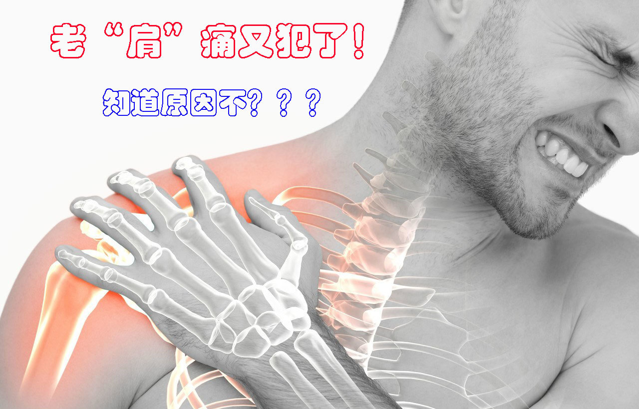 肩部疼痛是肩关节及其周围的肌肉,筋膜,神经等组织受到刺激或损伤后以