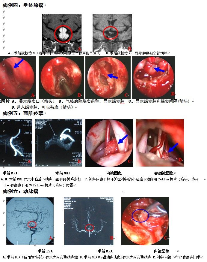 透明隔囊腫,腦室系統囊腫及腫瘤,巨大囊性顱咽管瘤,蛛網膜囊腫,松果體