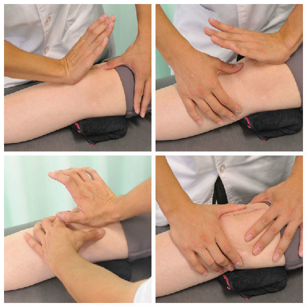 髌骨松动术对于膝关节活动度康复至关重要 - 好大夫在线