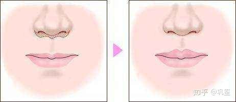 1539655101174090.jpg v2-6bd3b92a8b630d0b9ad3b5e6507bc54c_r.jpg