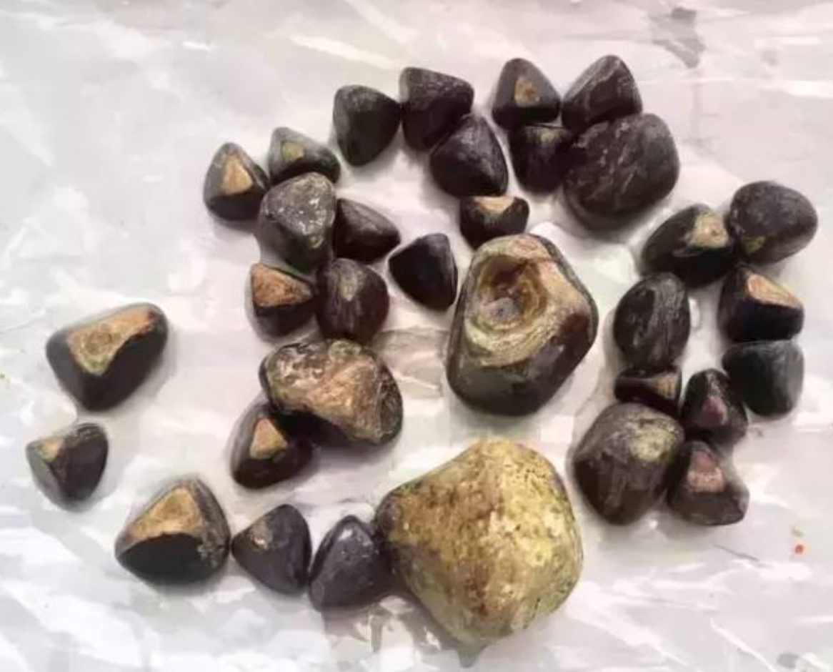 吃什么药能消除胆结石 xYYBAFvkOBWARfVtAA97AxNCFIk299.png?_ms_=d143