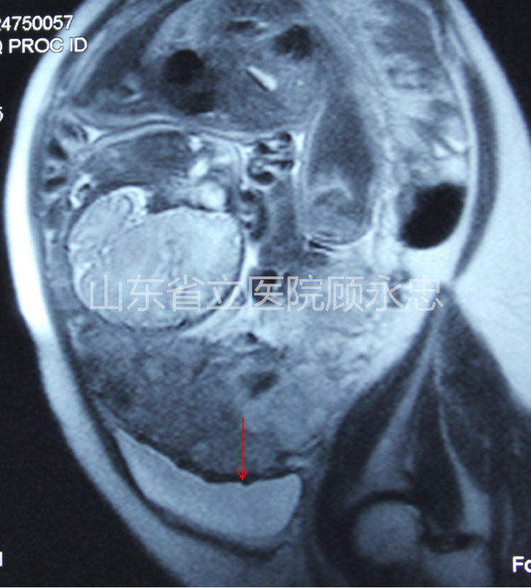 mmexport1560081223799.jpg