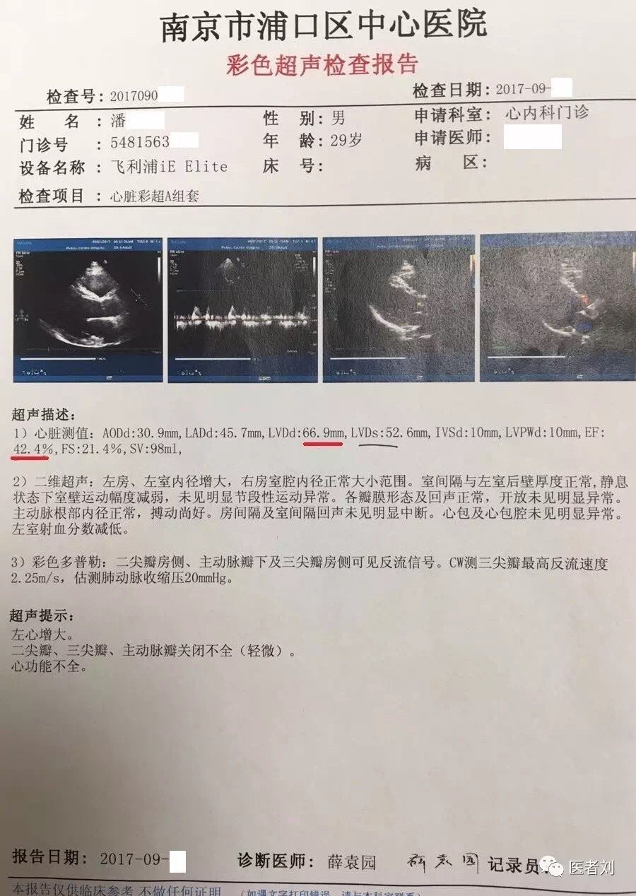 图4 治疗后心脏超声