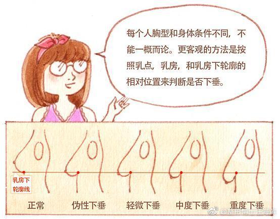 胸部本身的构造决定了有的胸部会下垂,会困扰很多的求美者.