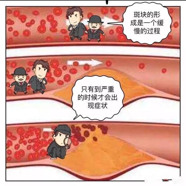 做到这3点才能预防血栓预防心梗预防脑梗人人都能做到